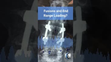 Untold Physio Stories Podcast - Fusions and End Range Loading?