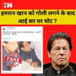 Fact Check : Pakistan के पूर्व PM Imran Khan को गोली लगने के बाद सर पाई आई चोट की तस्वीर की सच्चाई