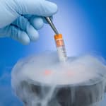 From Hair to Flesh: Is Stem Cell Therapy a Hope to Treat Diseases?