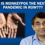 Is Monkeypox The Next Pandemic? In Talks With Dr Sangram Patil| Skin Disease Symptom| Virus| Health