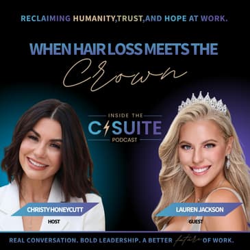 When Hair Loss Meets the Crown: Identity, Empathy & Leading Through It | EP65