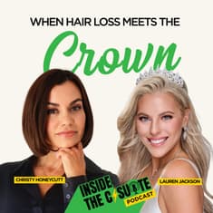 When Hair Loss Meets the Crown: Identity, Empathy & Leading Through It | EP65