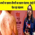 Mumbai में बेकाबू हुआ खसरा(Measles) | बच्चे हो रहे है संक्रमित | Dharavi में लगाए गए Camp