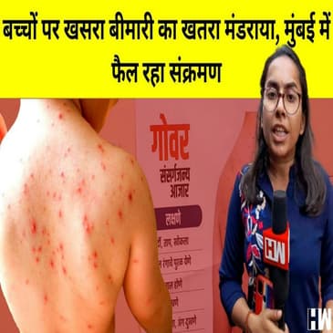Mumbai में बेकाबू हुआ खसरा(Measles) | बच्चे हो रहे है संक्रमित | Dharavi में लगाए गए Camp