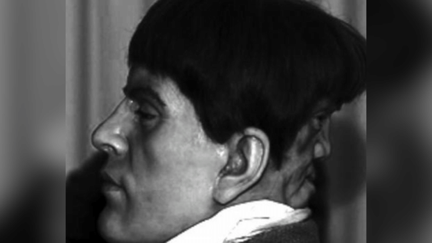 A Lovely Young Man with a Terrible Secret: Edward Mordrake