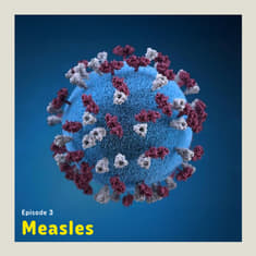 Measles