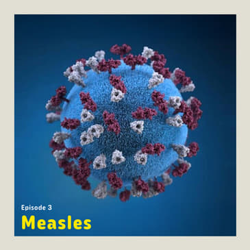 Measles